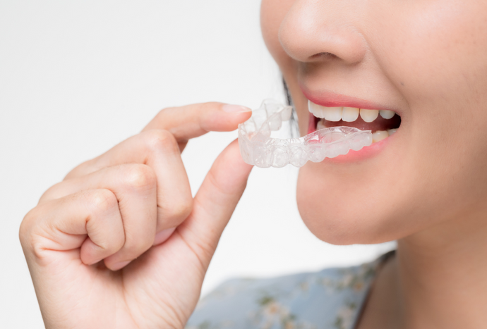 Top 10 Benefits of Clear Aligners for New Zealand Patients in 2025
