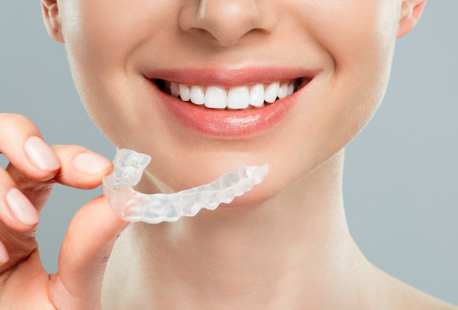 Teeth Aligners vs. Clear Braces in New Zealand: Which Looks Better?