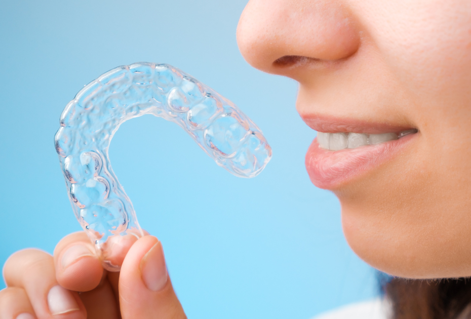 Are Clear Aligners Right for You? Signs You’re a Good Candidate in NZ