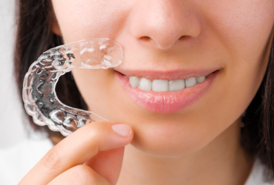 Can Clear Aligners Fix Gaps, Crowding & Crooked Teeth?