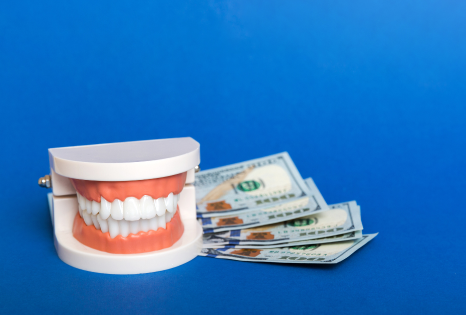 How Much Do Clear Aligners Cost in New Zealand? Real Pricing Explained