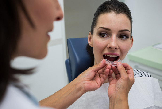 Dental Braces in NZ vs At-Home Aligners: Which One Fits Your Personality?